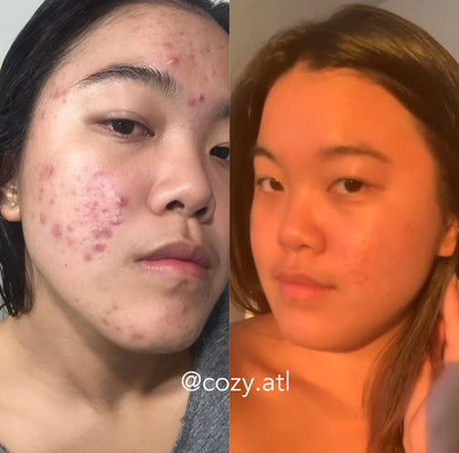 Vitalia Paradoxa Detox Acne Face + Body Wash