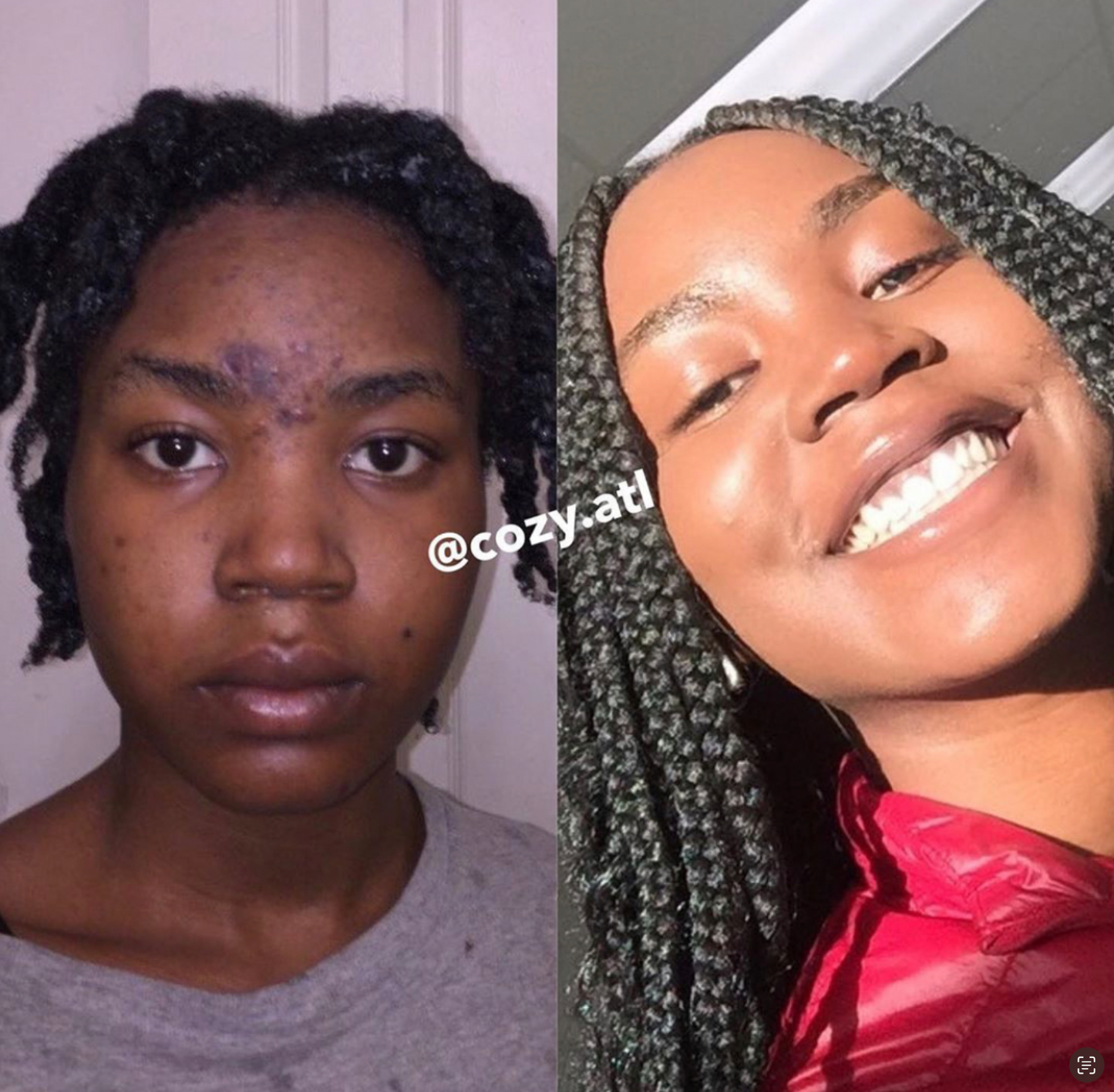 Rain Dance™ Daily  Moisturizer + Vitalia Paradoxa Acne Liquid Soap