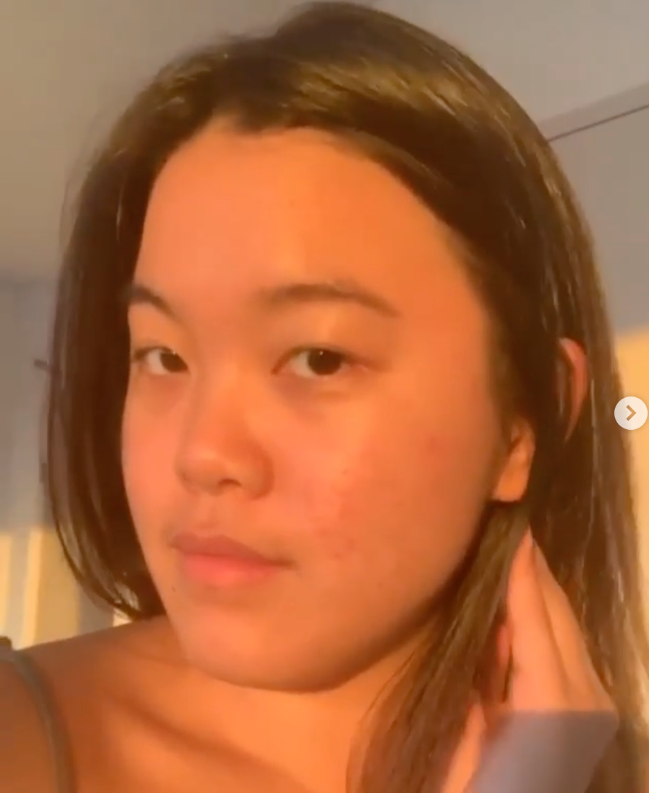 Acne + Texture Daily Face Bundle Set