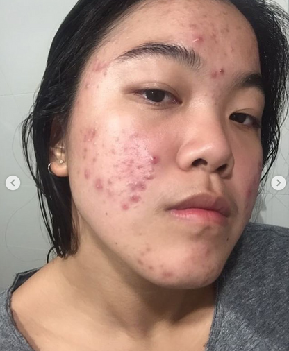 Rain Dance™ Daily Moisturizer